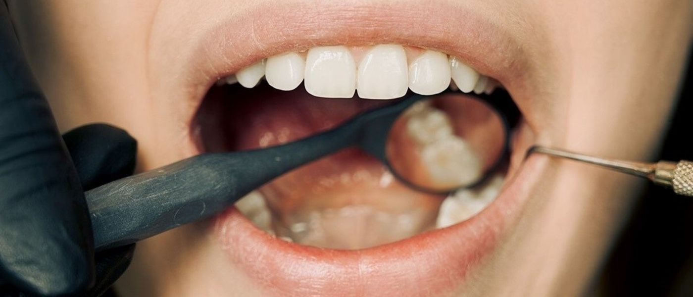 Zahnfleischrückgang stoppen: Halte dein Zahnfleisch gesund